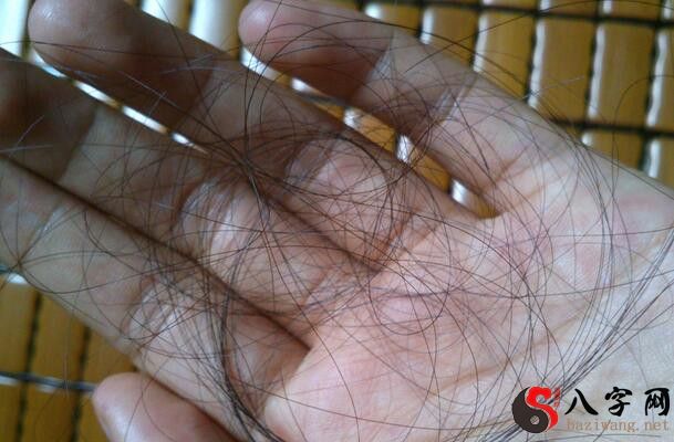 梦到头发掉了一撮